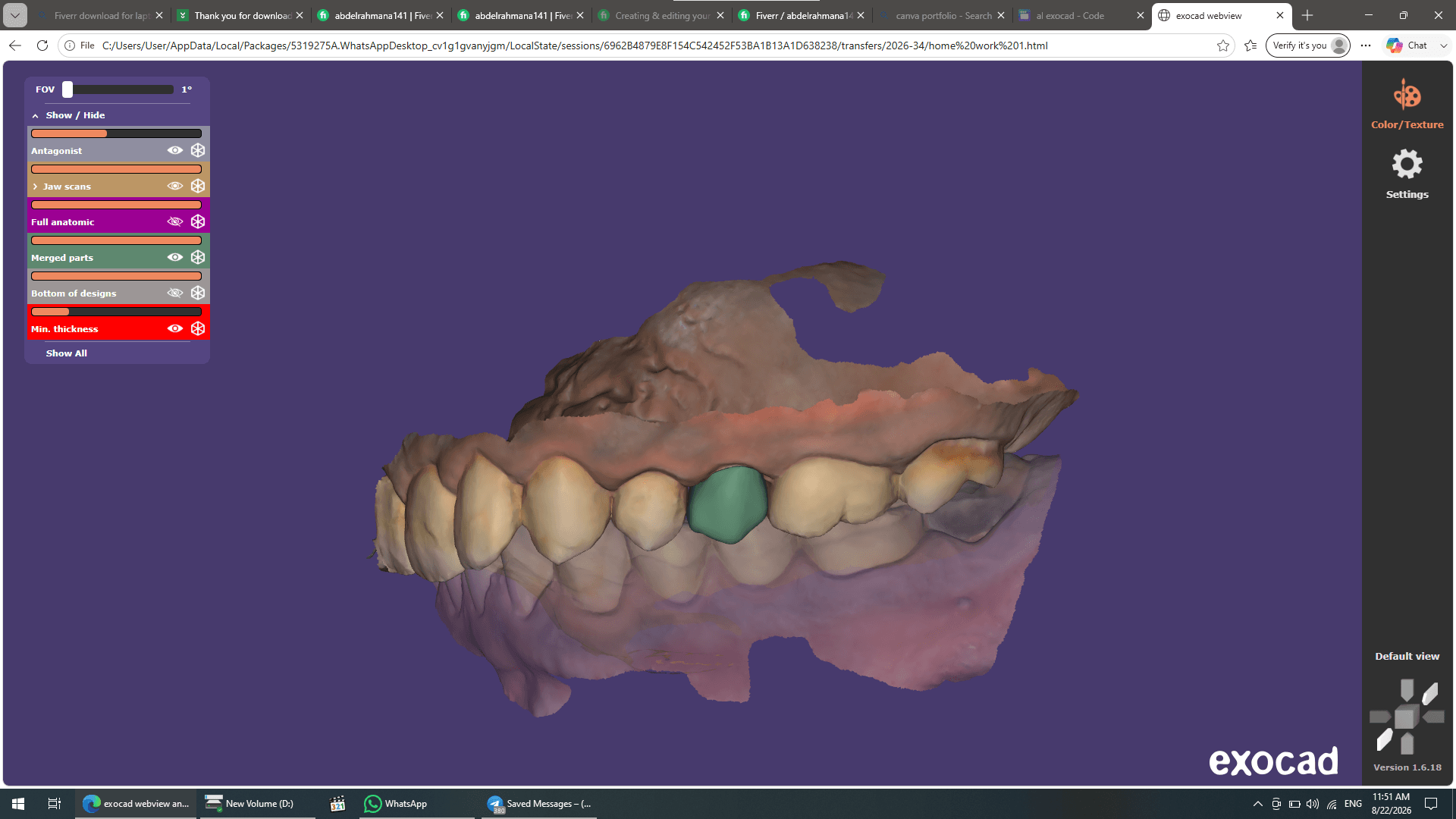 Professional Exocad Dental CAD Design – Crowns, Bridges & More