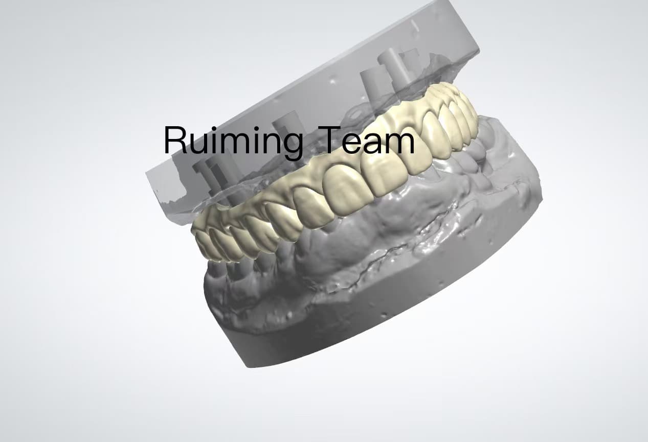 Full‑Arch Provisional Restoration CAD Design | All‑on‑X