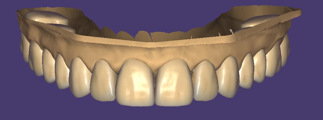Designed over 20,000 dental units. Exocad — 10 years of experience